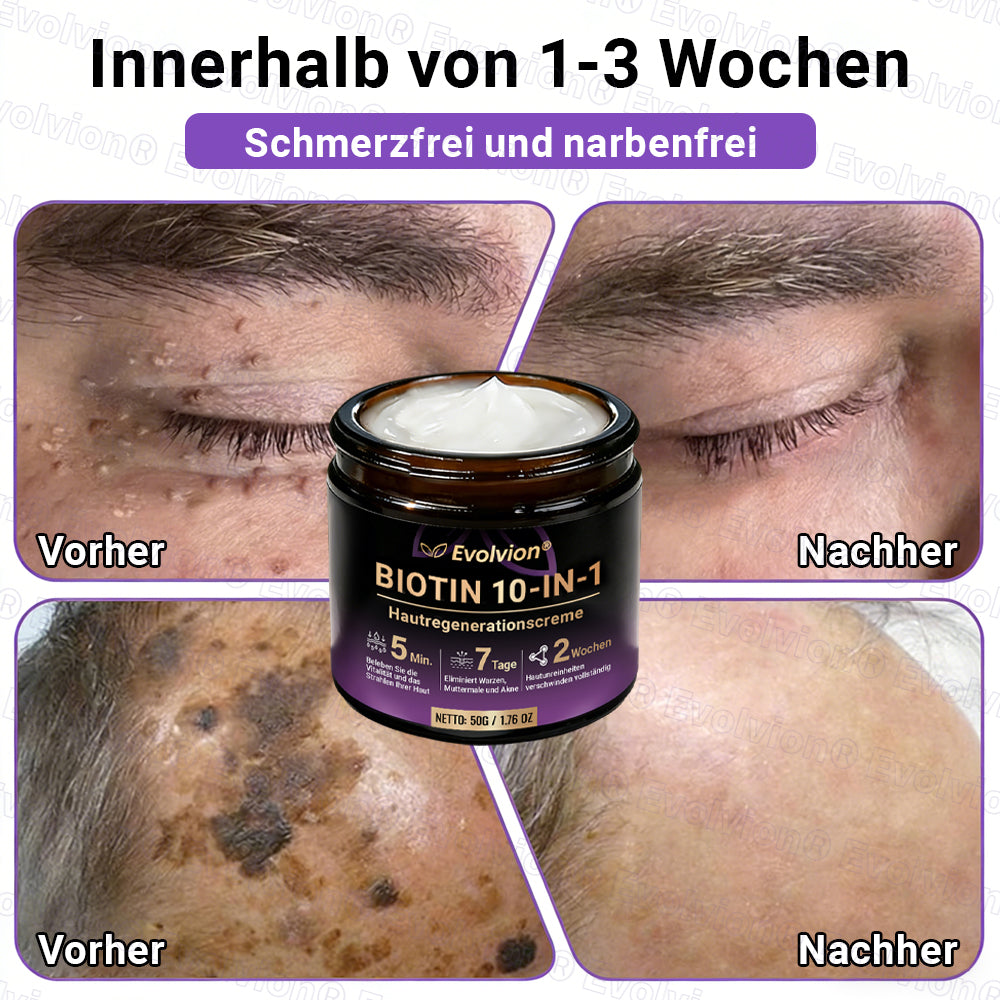 Hergestellt und versendet aus Deutschland ✨ Evolvion® Biotin 10-in-1 Hautrestaurationscreme 🔥🔥🔥