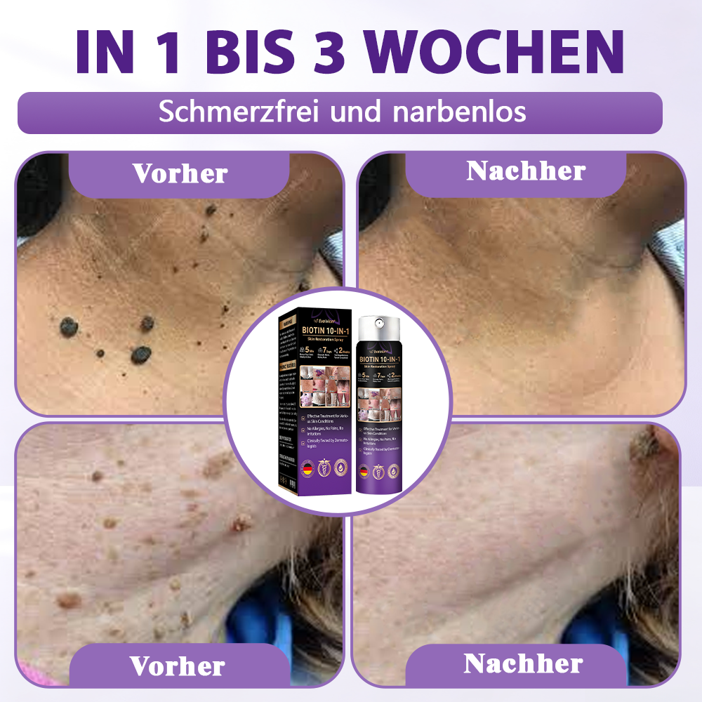 Hergestellt und versandt aus Deutschland ✨Evolvion® Biotin 10-in-1 Hautregenerations-Spray -up