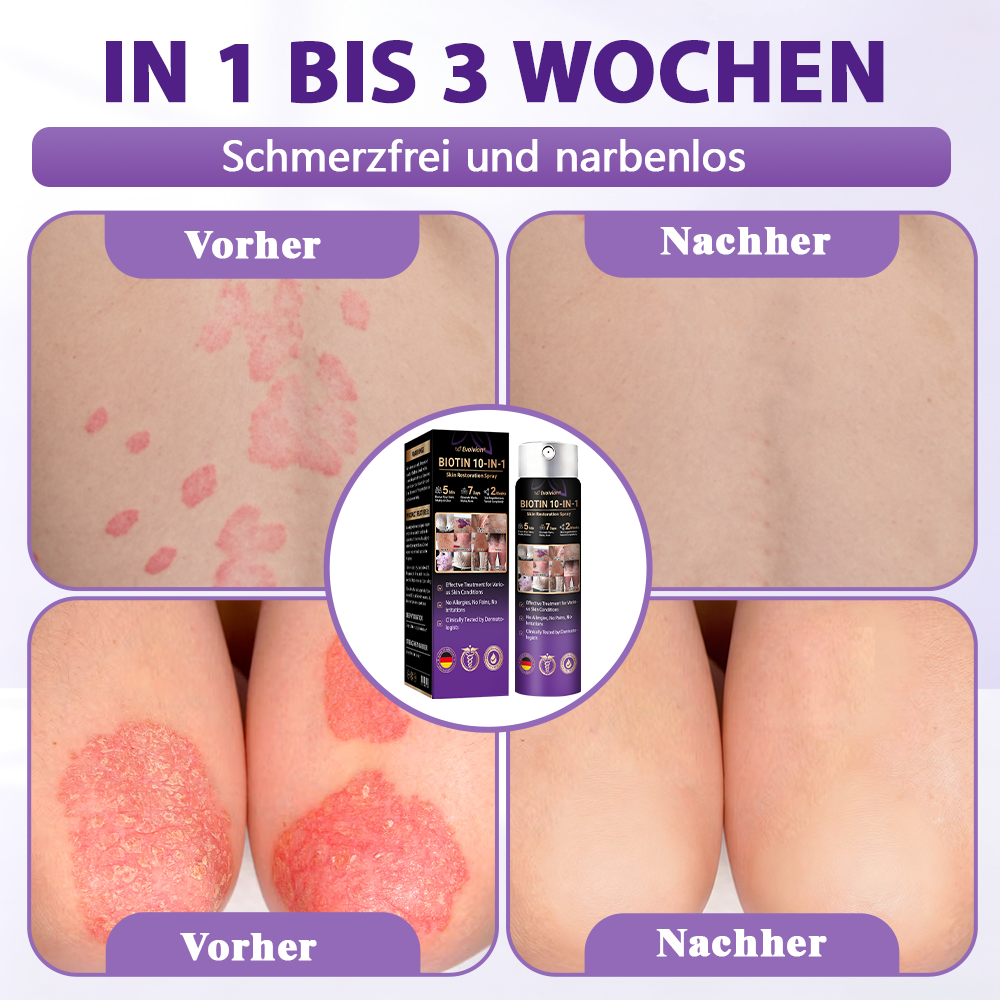 Hergestellt und versandt aus Deutschland ✨Evolvion® Biotin 10-in-1 Hautregenerations-Spray -up