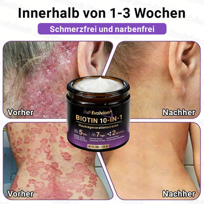 Hergestellt und versendet aus Deutschland ✨ Evolvion® Biotin 10-in-1 Hautrestaurationscreme 🔥🔥🔥