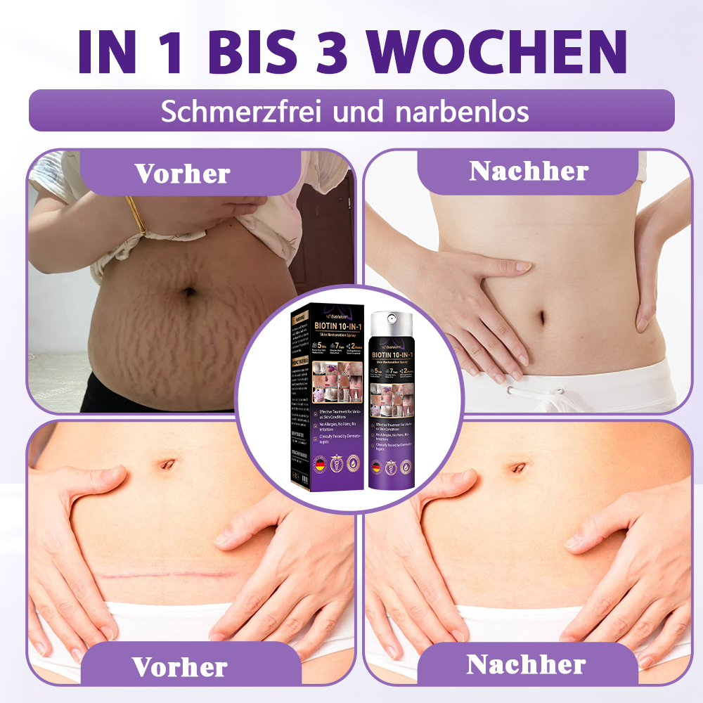 Hergestellt und versandt aus Deutschland ✨Evolvion® Biotin 10-in-1 Hautregenerations-Spray -up