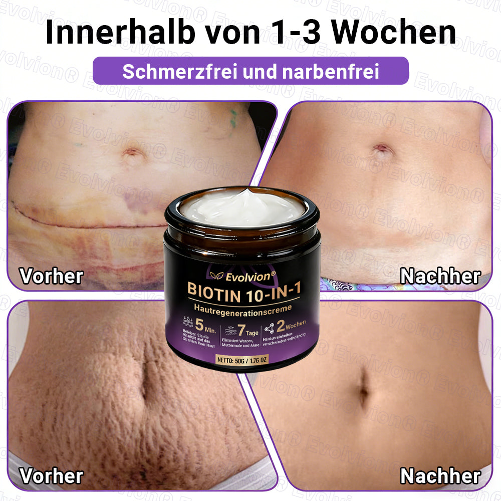 Hergestellt und versendet aus Deutschland ✨ Evolvion® Biotin 10-in-1 Hautrestaurationscreme 🔥🔥🔥