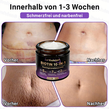 Hergestellt und versendet aus Deutschland ✨ Evolvion® Biotin 10-in-1 Hautrestaurationscreme 🔥🔥🔥