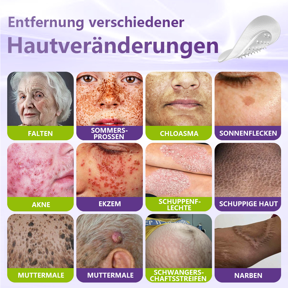 GFOUK® Lösliches Mikronadel-Pflaster zur Entfernung von Hautanhängseln auf Pflanzenbasis🍀🍀