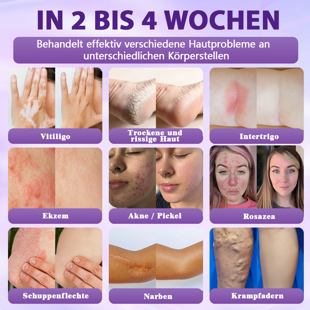 Hergestellt und versandt aus Deutschland ✨Evolvion® Biotin 10-in-1 Hautregenerations-Spray -up