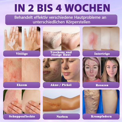 Hergestellt und versandt aus Deutschland ✨Evolvion® Biotin 10-in-1 Hautregenerations-Spray -up