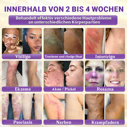 Hergestellt und versendet aus Deutschland ✨ Evolvion® Biotin 10-in-1 Hautrestaurationscreme 🔥🔥🔥