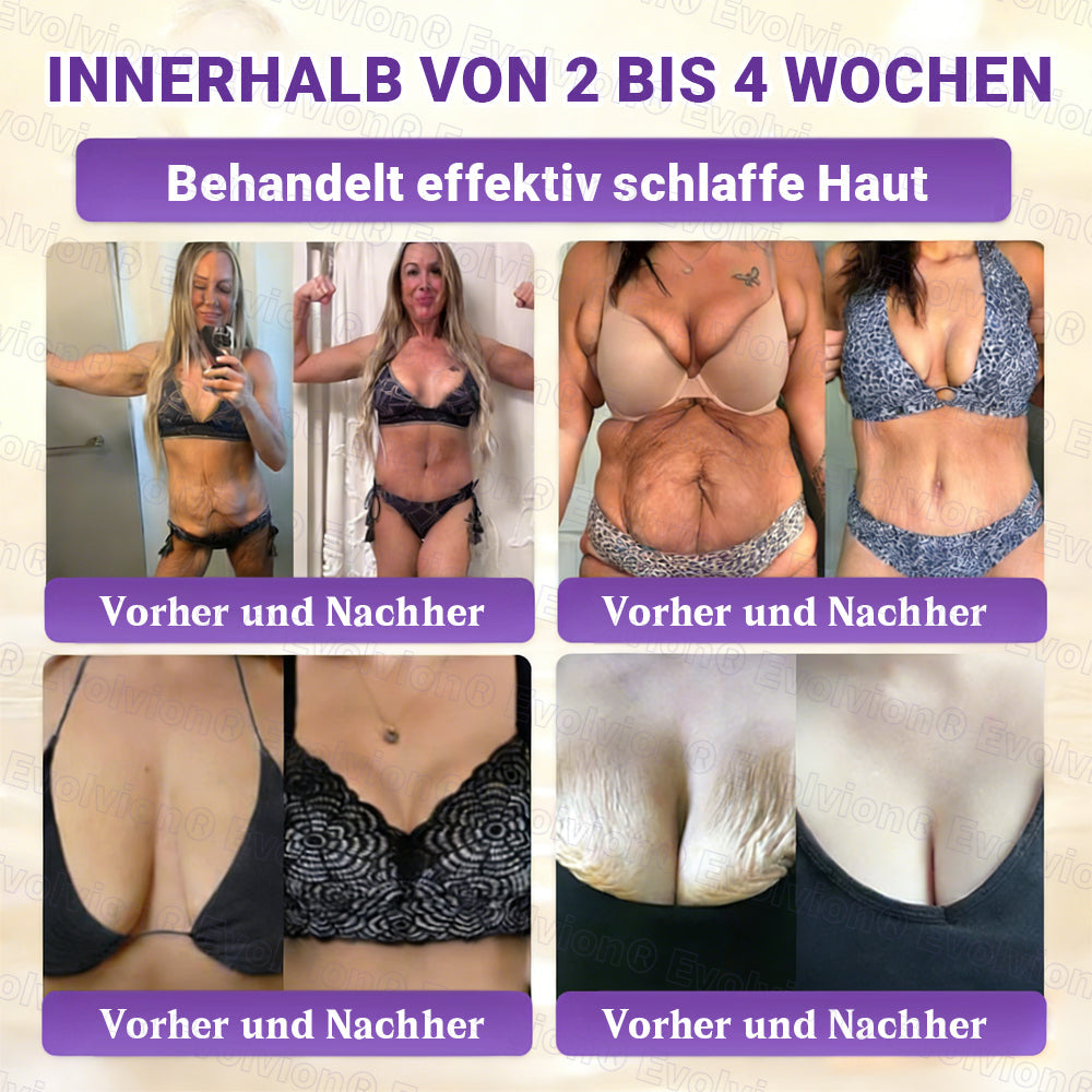 Hergestellt und versendet aus Deutschland ✨ Evolvion® Biotin 10-in-1 Hautrestaurationscreme 🔥🔥🔥