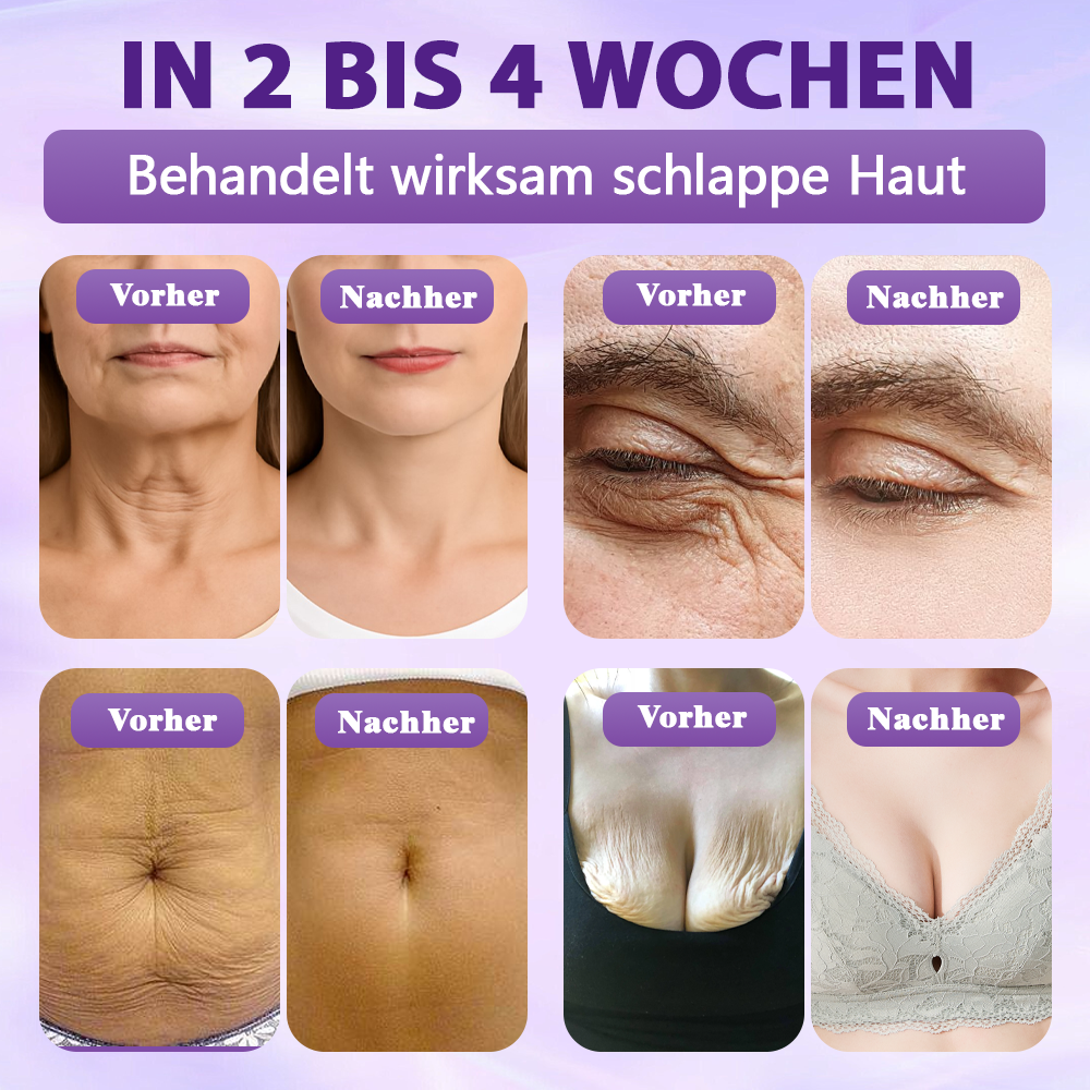 Hergestellt und versandt aus Deutschland ✨Evolvion® Biotin 10-in-1 Hautregenerations-Spray -up