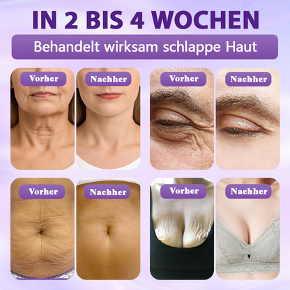 Hergestellt und versandt aus Deutschland ✨Evolvion® Biotin 10-in-1 Hautregenerations-Spray -up