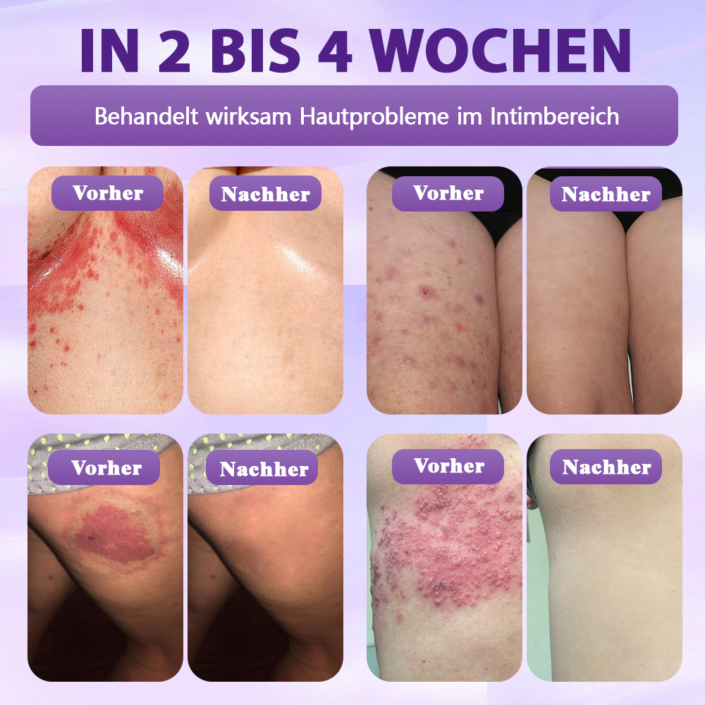 Hergestellt und versandt aus Deutschland ✨Evolvion® Biotin 10-in-1 Hautregenerations-Spray -up