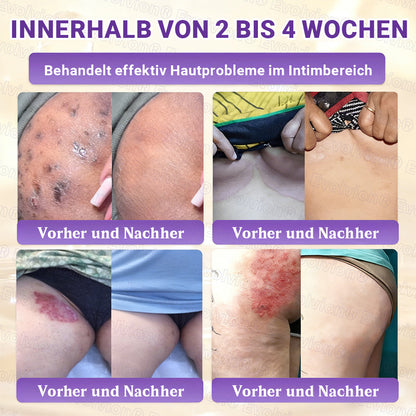 Hergestellt und versendet aus Deutschland ✨ Evolvion® Biotin 10-in-1 Hautrestaurationscreme 🔥🔥🔥