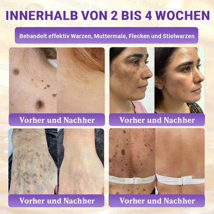 Hergestellt und versendet aus Deutschland ✨ Evolvion® Biotin 10-in-1 Hautrestaurationscreme 🔥🔥🔥