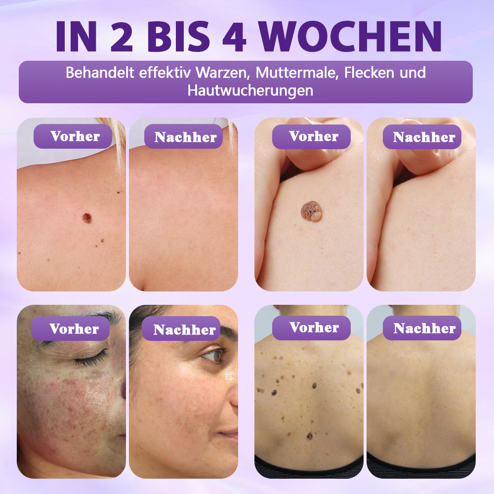 Hergestellt und versandt aus Deutschland ✨Evolvion® Biotin 10-in-1 Hautregenerations-Spray -up
