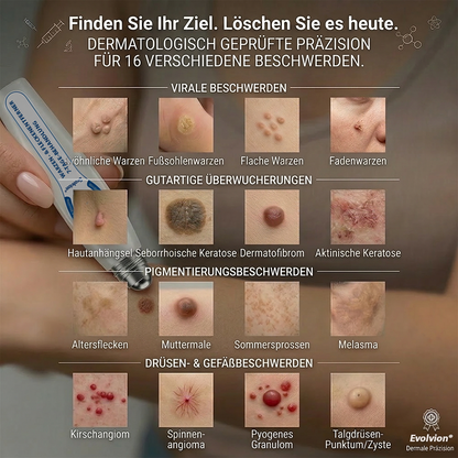 Hergestellt und versandt aus Deutschland ✨ Evolvion® 𝟕-Tage-Hautanhangs- & Pigmentflecken-Entferner – Schmerzfreie und narbenfreie fortschrittliche Lösung zur Beseitigung von Hautunreinheiten mit Roll-On-Pen 🌼