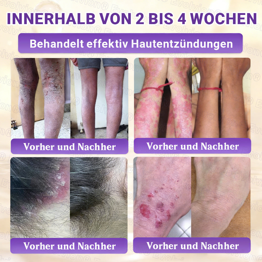 Hergestellt und versendet aus Deutschland ✨ Evolvion® Biotin 10-in-1 Hautrestaurationscreme 🔥🔥🔥