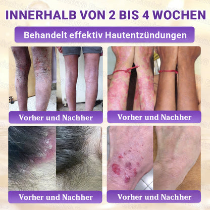 Hergestellt und versendet aus Deutschland ✨ Evolvion® Biotin 10-in-1 Hautrestaurationscreme 🔥🔥🔥