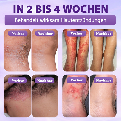 Hergestellt und versandt aus Deutschland ✨Evolvion® Biotin 10-in-1 Hautregenerations-Spray -up