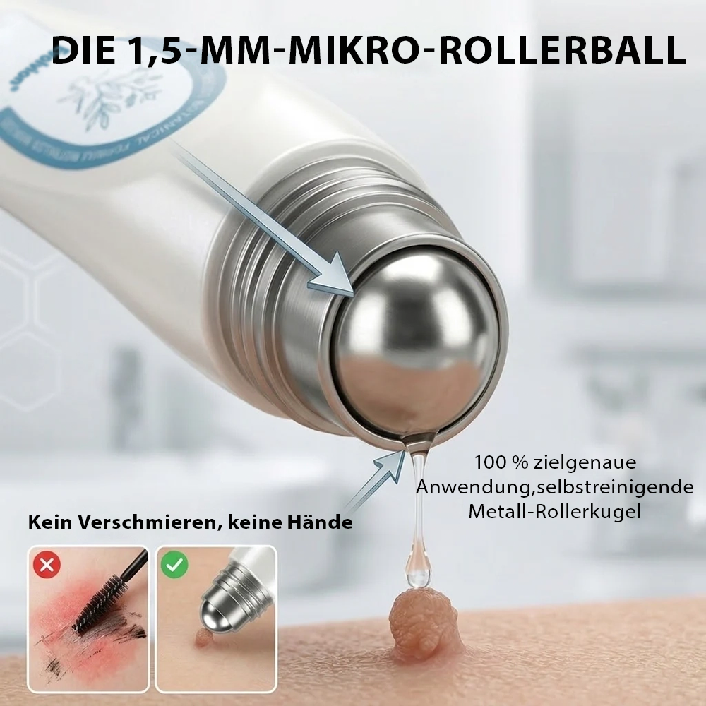 Hergestellt und versandt aus Deutschland ✨ Evolvion® 𝟕-Tage-Hautanhangs- & Pigmentflecken-Entferner – Schmerzfreie und narbenfreie fortschrittliche Lösung zur Beseitigung von Hautunreinheiten mit Roll-On-Pen 🌼