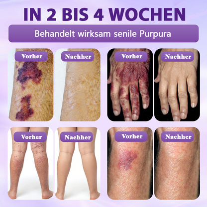 Hergestellt und versandt aus Deutschland ✨Evolvion® Biotin 10-in-1 Hautregenerations-Spray -up