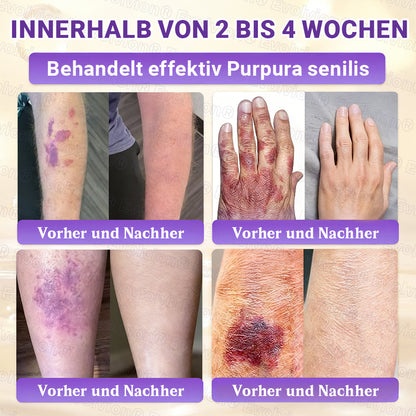 Hergestellt und versendet aus Deutschland ✨ Evolvion® Biotin 10-in-1 Hautrestaurationscreme 🔥🔥🔥
