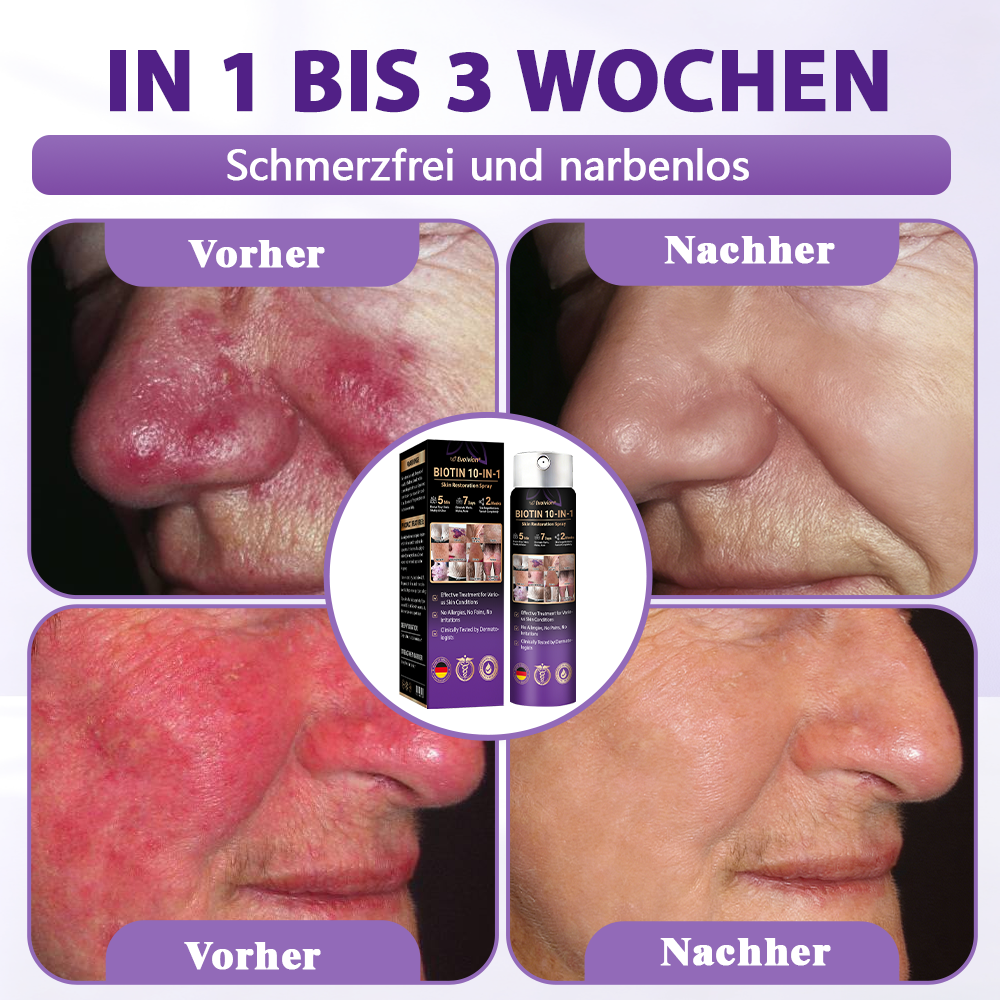 Hergestellt und versandt aus Deutschland ✨Evolvion® Biotin 10-in-1 Hautregenerations-Spray -up