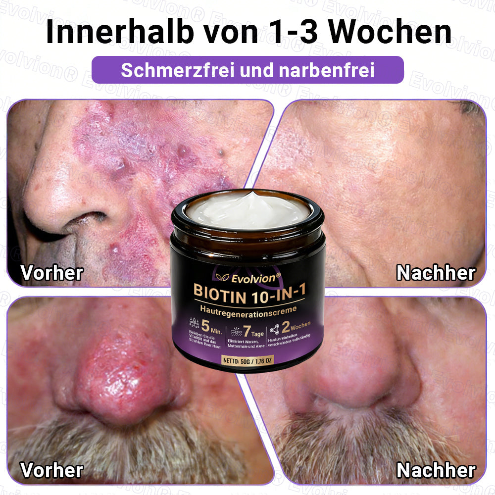 Hergestellt und versendet aus Deutschland ✨ Evolvion® Biotin 10-in-1 Hautrestaurationscreme 🔥🔥🔥