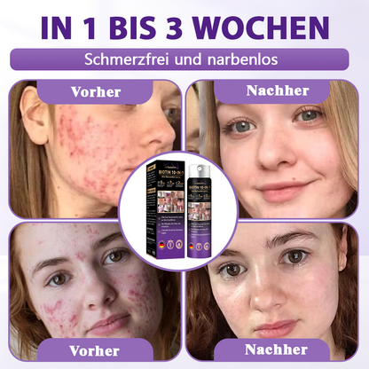 Hergestellt und versandt aus Deutschland ✨Evolvion® Biotin 10-in-1 Hautregenerations-Spray -up