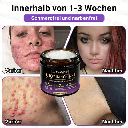 Hergestellt und versendet aus Deutschland ✨ Evolvion® Biotin 10-in-1 Hautrestaurationscreme 🔥🔥🔥